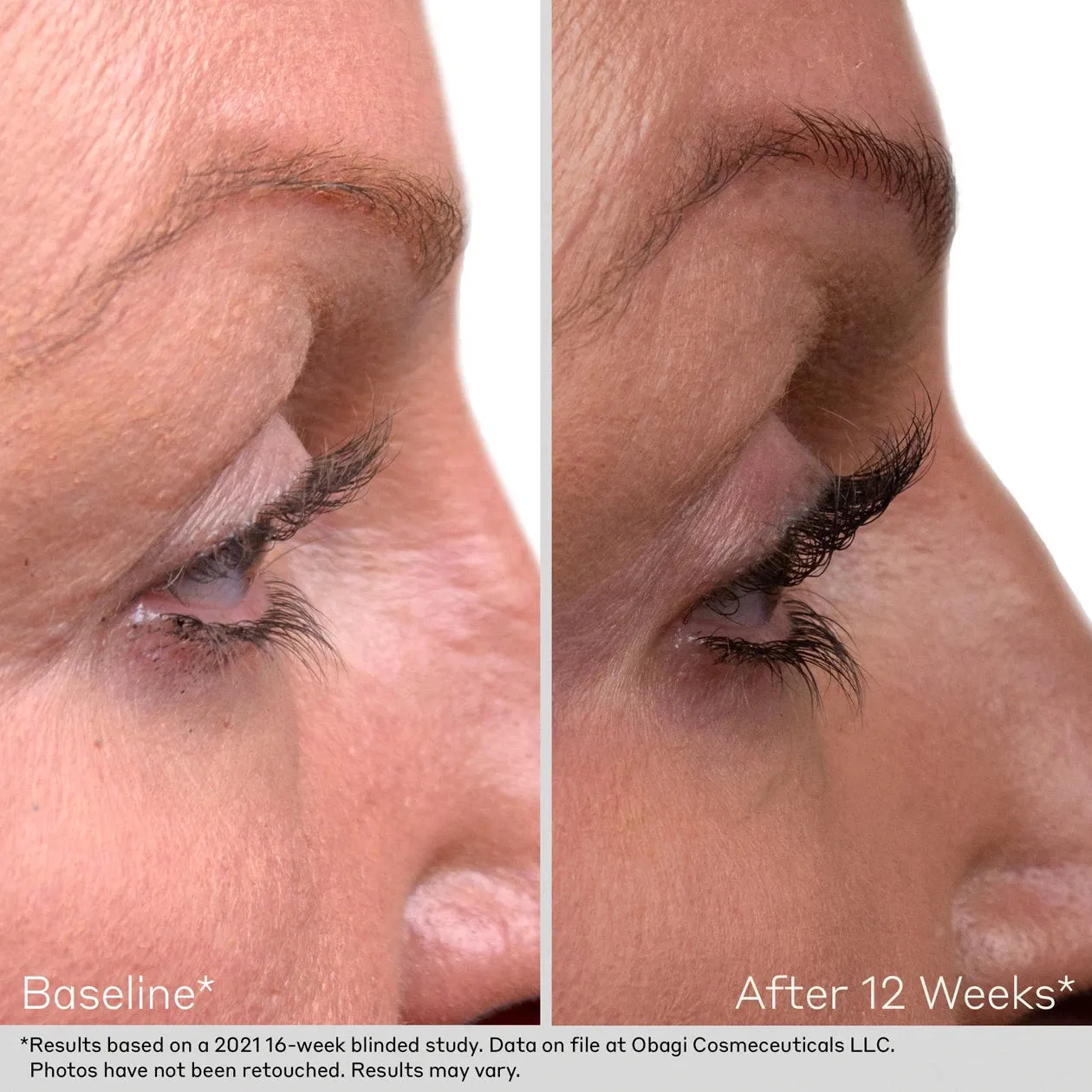 Obagi® Lash and Brow Serum Set